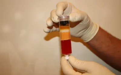 The Health Benefits of Tissue Support Therapy for Arthritis