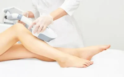 Minimizing Hormonal Hair Growth with Cosmetic Laser and IPL Treatments