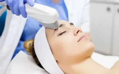 Improving Skin Imperfections With IPL Photofacials