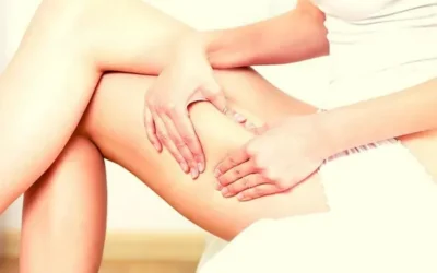 Boosting Collagen and Addressing Cellulite with Radiofrequency Treatment