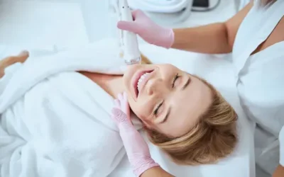 Treating Hyperpigmentation with DermaFrac Microneedling